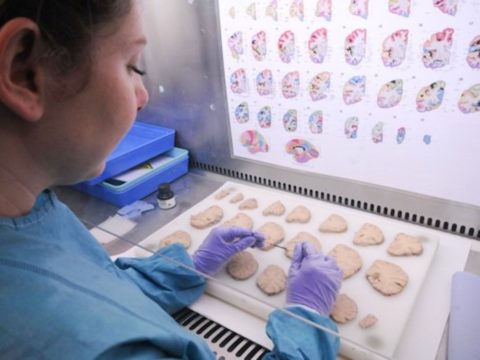 A look behind the scenes – how Alzheimer’s Research UK decides what research to fund