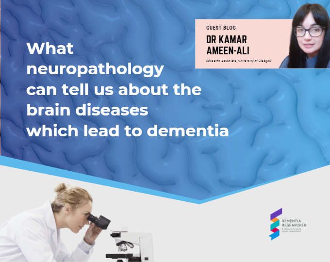 Blog – What neuropathology can tell us about the brain diseases which lead to dementia