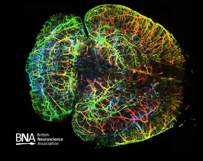 3D imaging of entire brains with light sheet microscopy