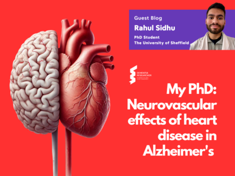 Blog – My PhD: Neurovascular effects of heart disease in Alzheimer’s